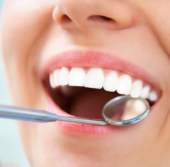 Clínica Dental Monident mujer con dientes sanos
