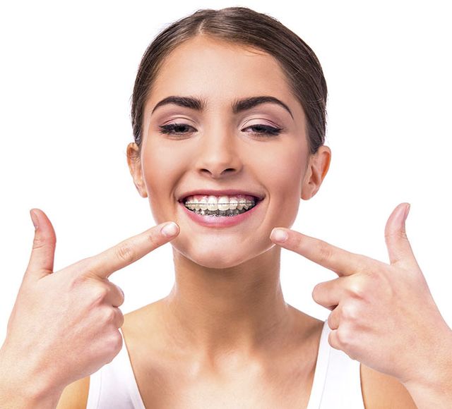 Mujer con ortodoncia